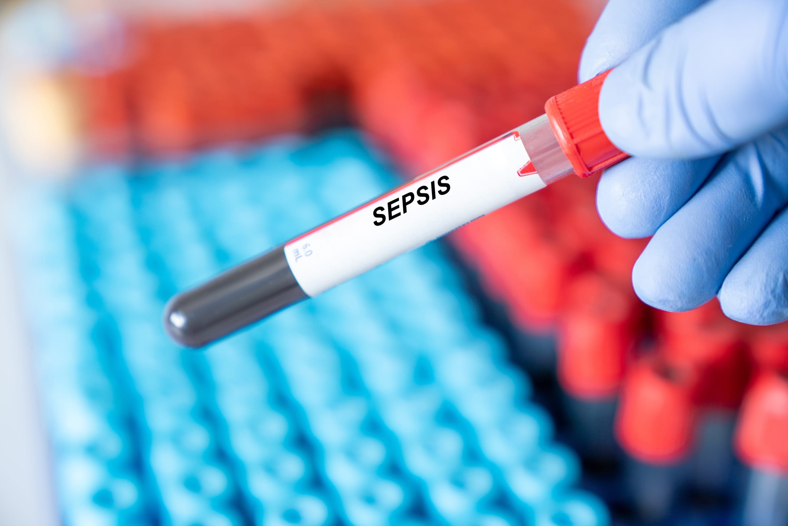 Sepsis-in-Deutschland-die-untersch-tzte-Gefahr